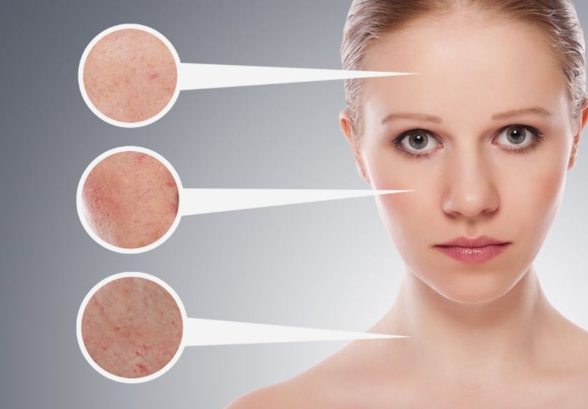 Thu nhỏ lỗ chân lông